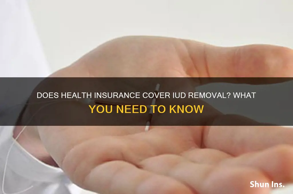 does health insurance cover iud removal