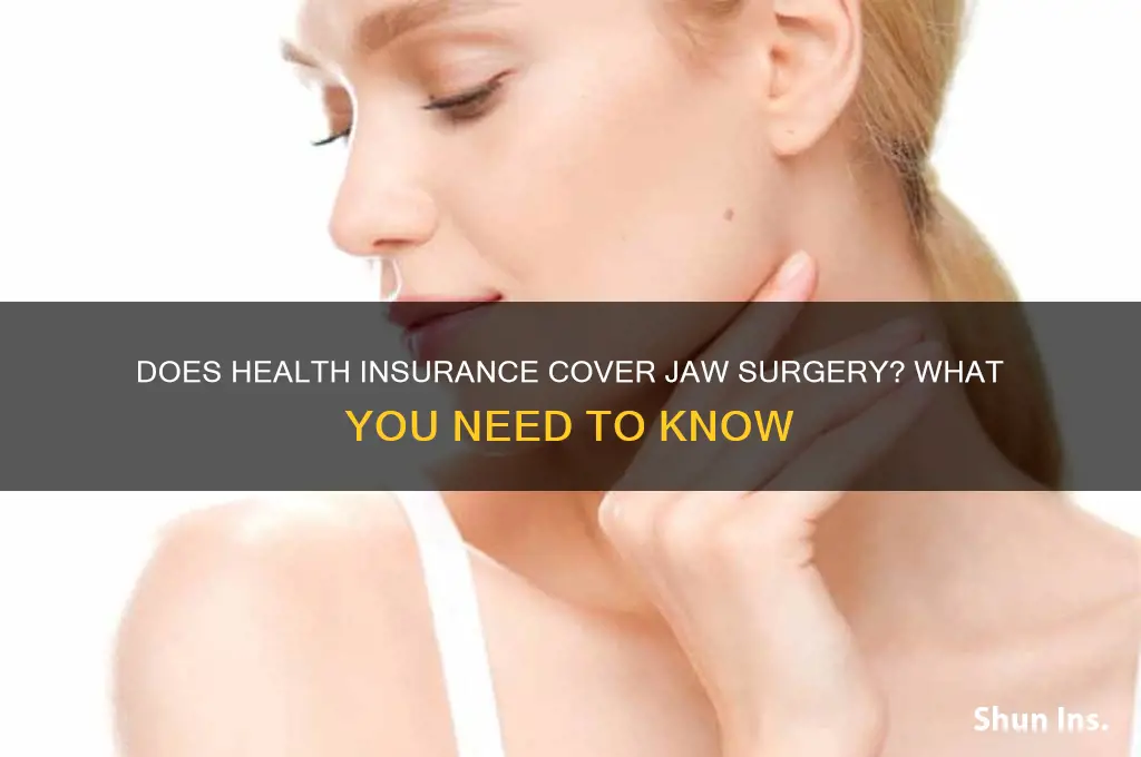 does health insurance cover jaw surgery