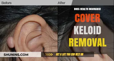 Health Insurance Coverage for Keloid Removal: What You Need to Know