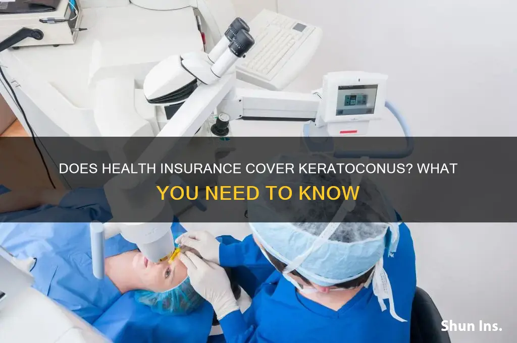 does health insurance cover keratoconus
