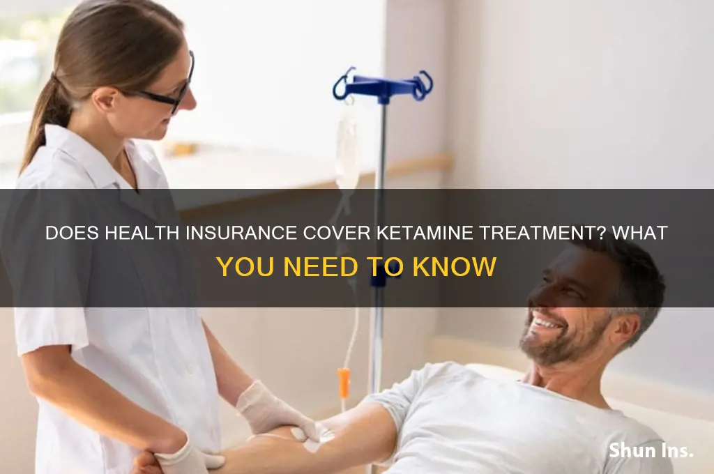 does health insurance cover ketemine treatment