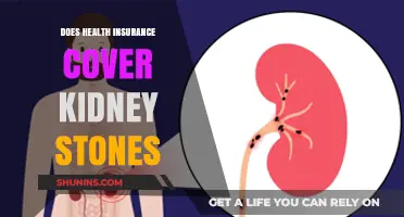 Does Health Insurance Cover Kidney Stones? What You Need to Know