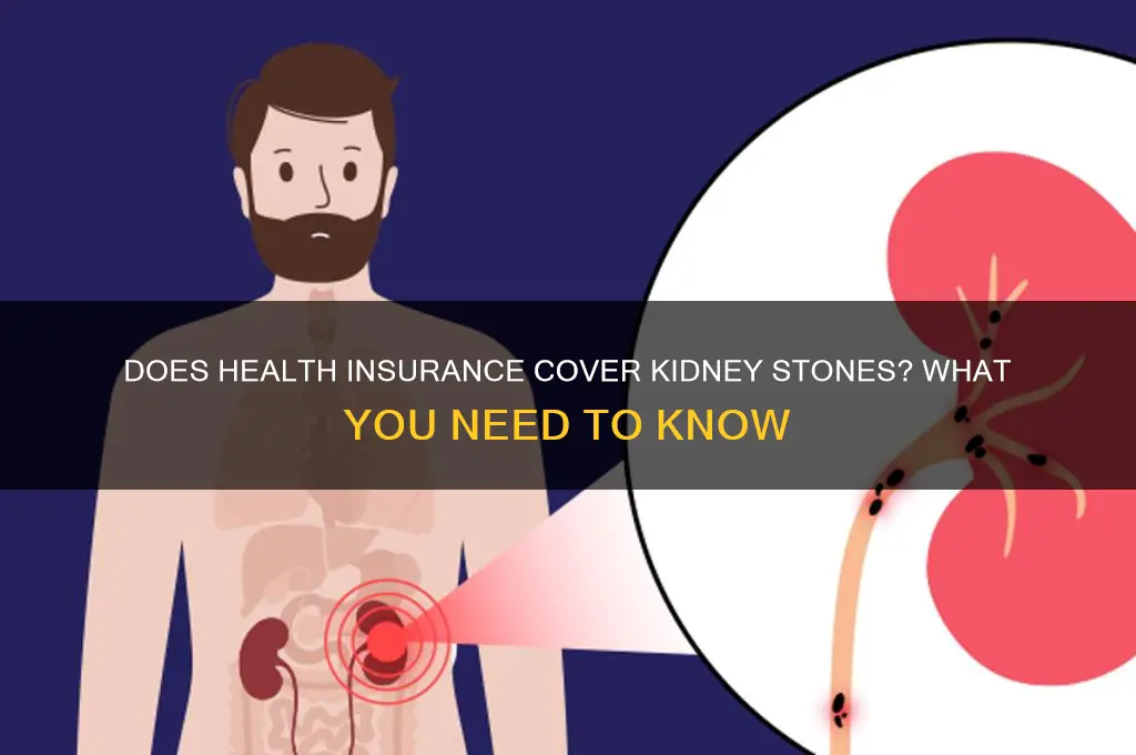does health insurance cover kidney stones