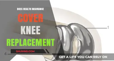 Does Health Insurance Cover Knee Replacement? What You Need to Know