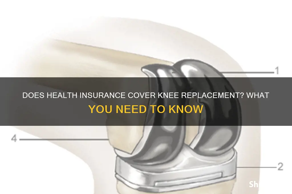 does health insurance cover knee replacement