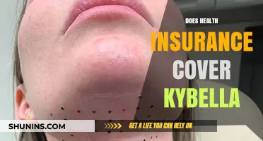 Does Health Insurance Cover Kybella? Understanding Coverage for Fat Reduction