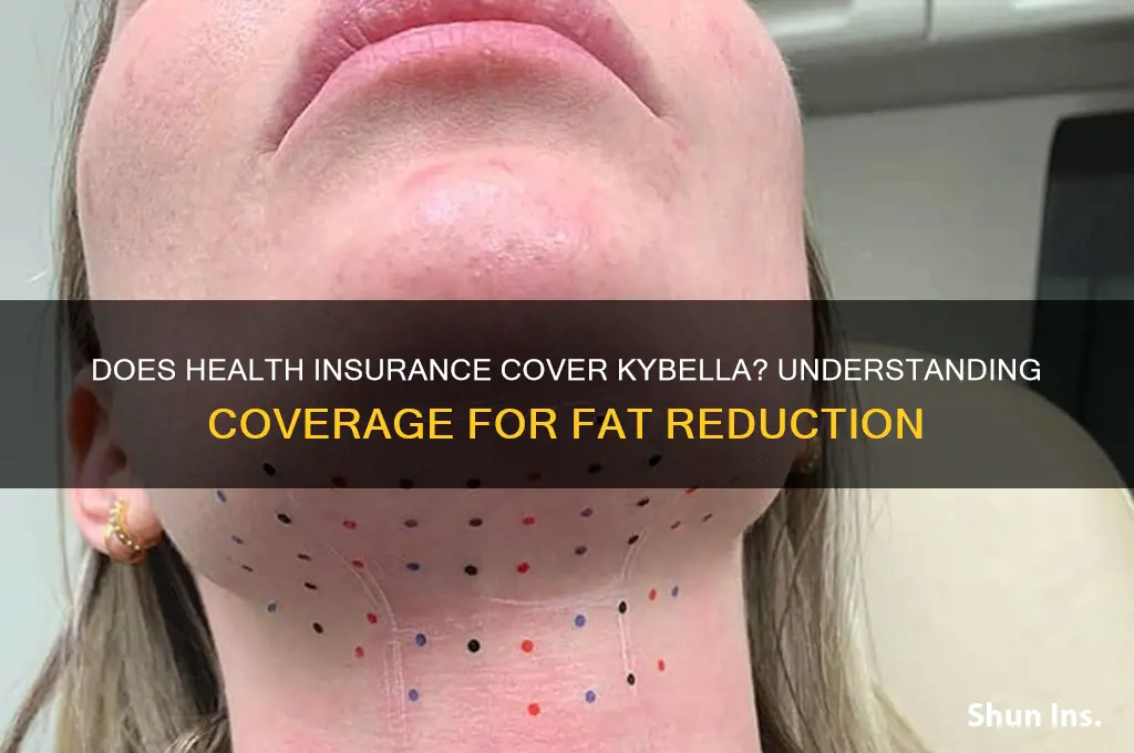 does health insurance cover kybella