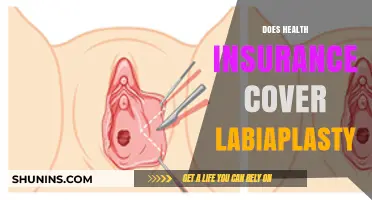 Does Health Insurance Cover Labiaplasty? Understanding Coverage and Costs