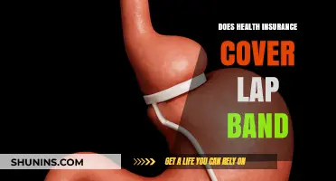 Does Health Insurance Cover Lap Band Surgery? What You Need to Know