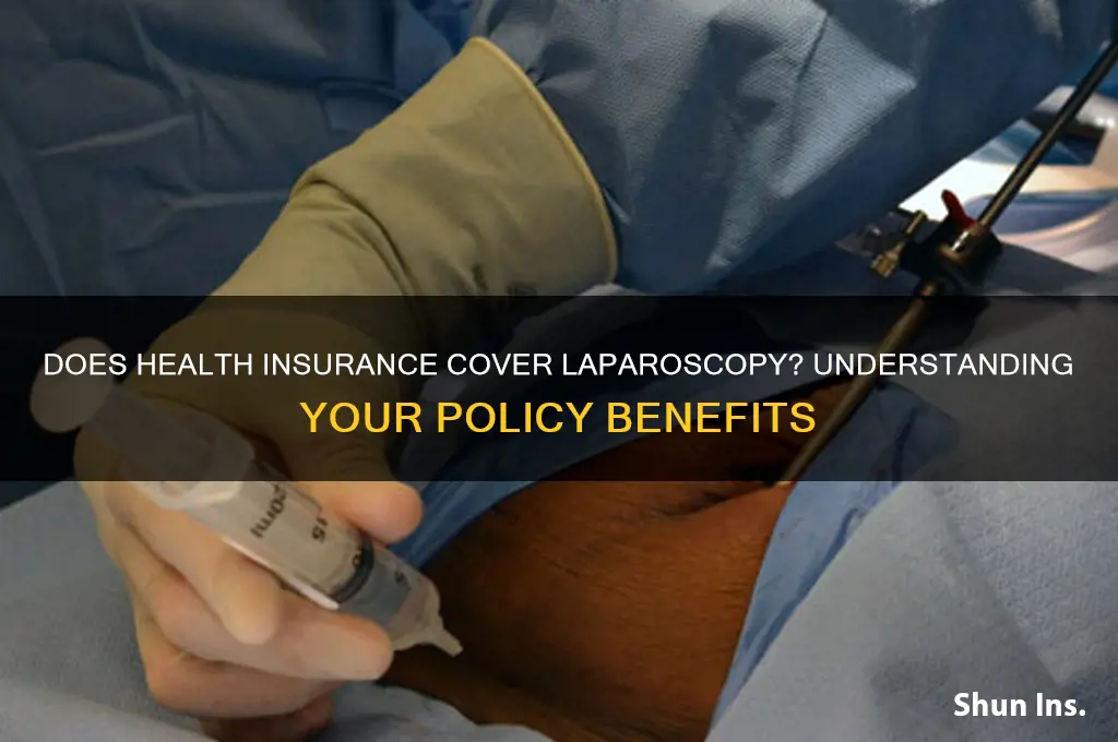 does health insurance cover laparoscopy
