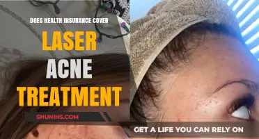 Does Health Insurance Cover Laser Acne Treatment? What You Need to Know