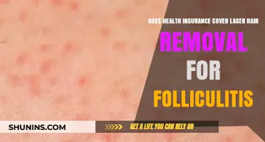 Health Insurance Coverage for Laser Hair Removal: Folliculitis Treatment Options