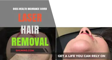 Does Health Insurance Cover Laser Hair Removal? What You Need to Know