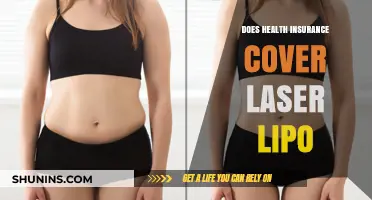 Does Health Insurance Cover Laser Lipo? What You Need to Know