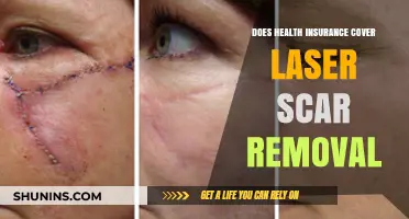 Does Health Insurance Cover Laser Scar Removal? What You Need to Know
