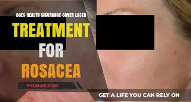 Does Health Insurance Cover Laser Treatment for Rosacea?