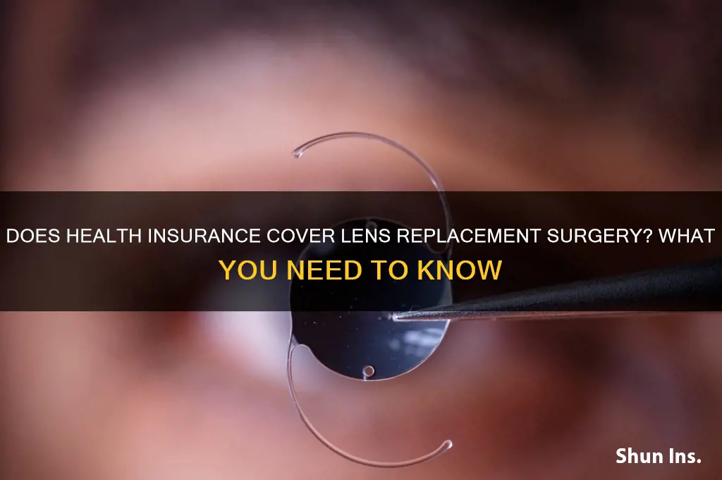 does health insurance cover lens replacement surgery