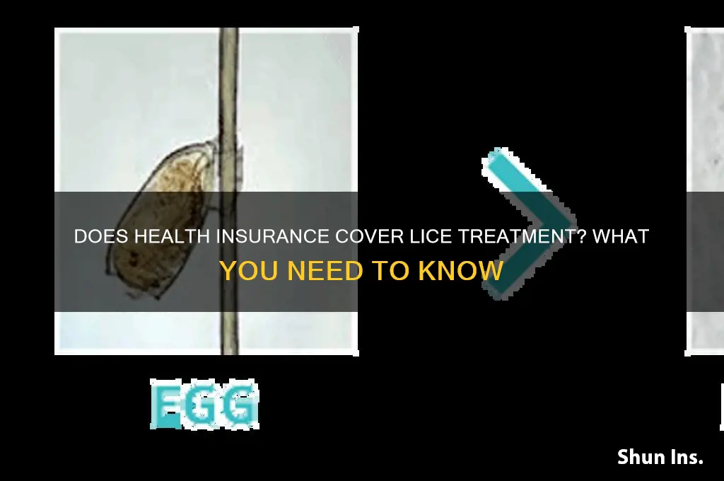 does health insurance cover lice treatment