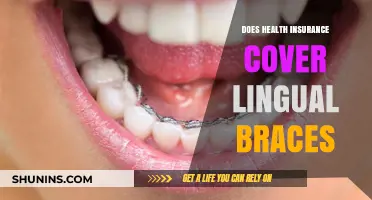 Does Health Insurance Cover Lingual Braces? What You Need to Know