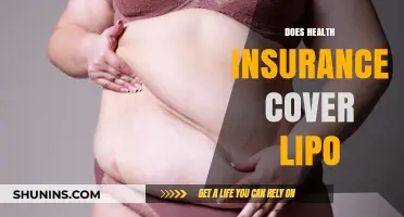 Does Health Insurance Cover Liposuction? What You Need to Know