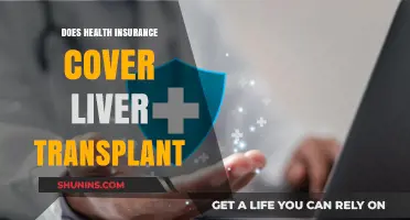 Does Health Insurance Cover Liver Transplants? What You Need to Know