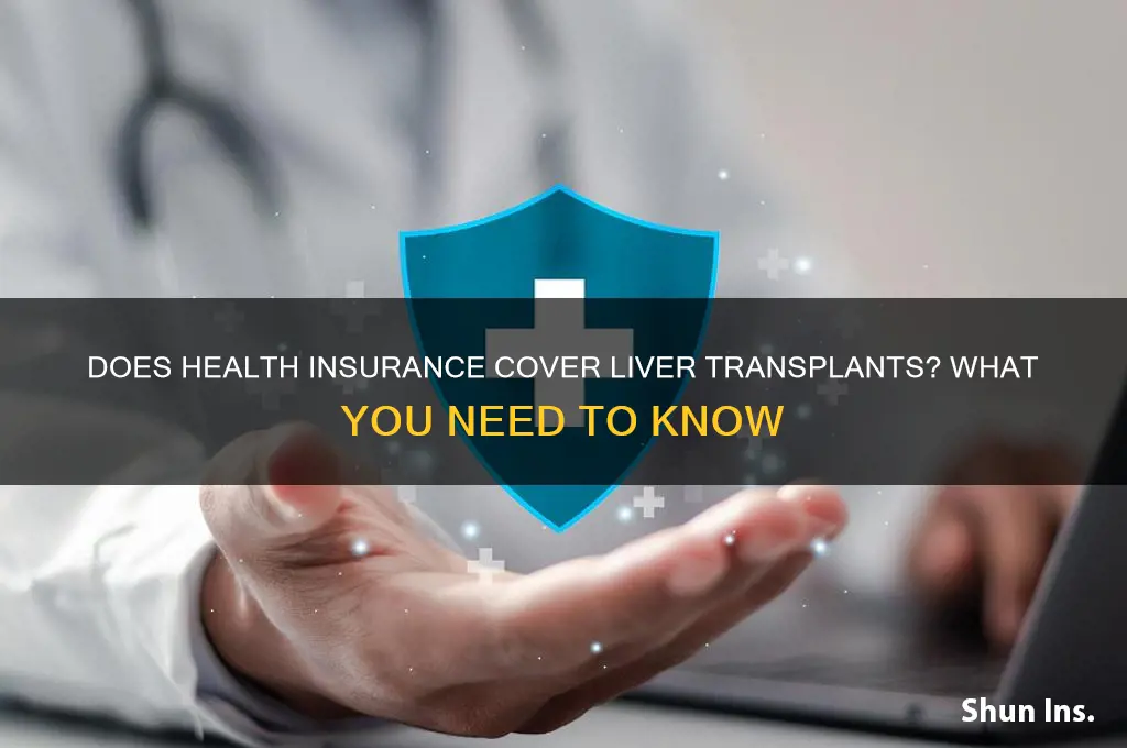 does health insurance cover liver transplant