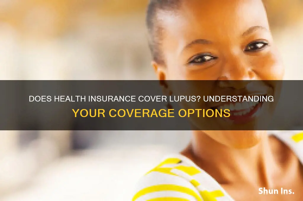 does health insurance cover lupus