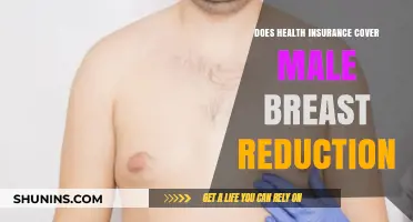 Does Health Insurance Cover Male Breast Reduction? What You Need to Know