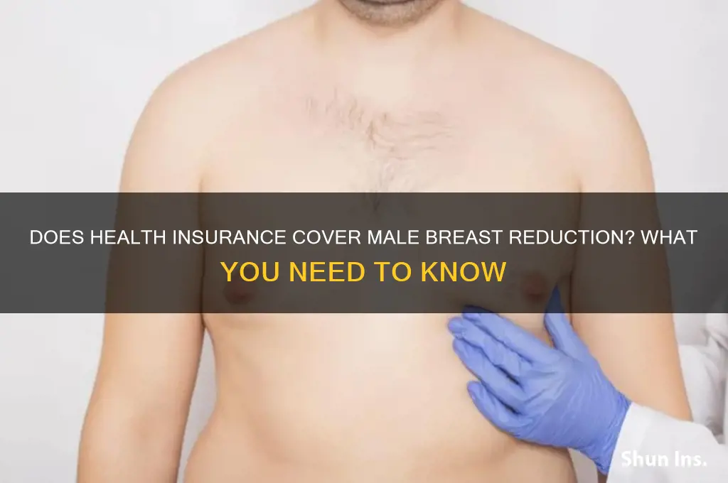 does health insurance cover male breast reduction