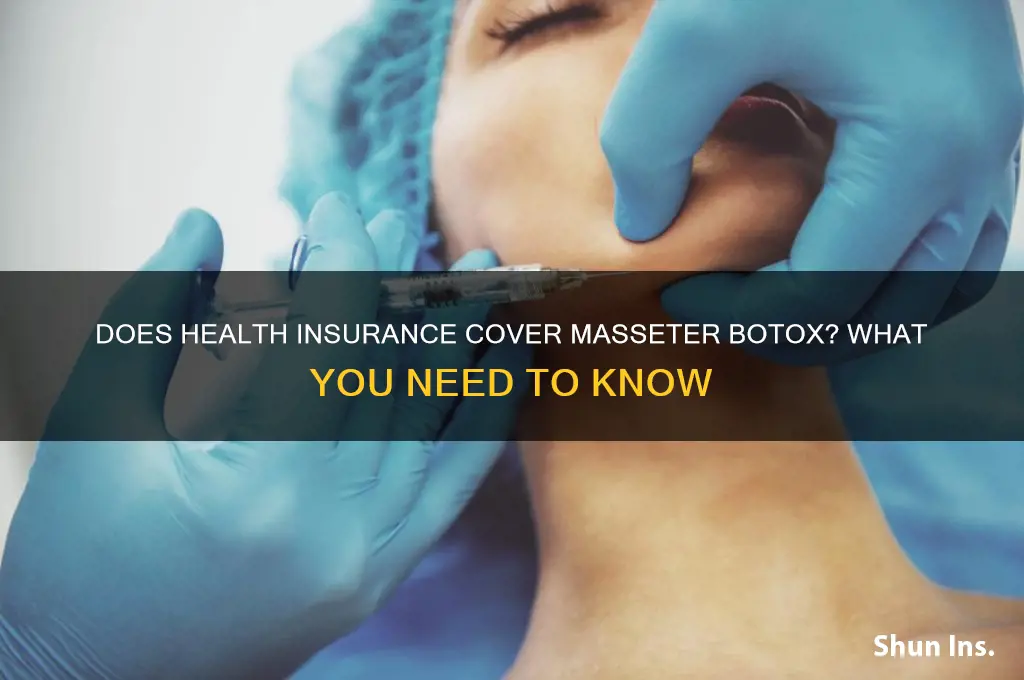 does health insurance cover masseter botox
