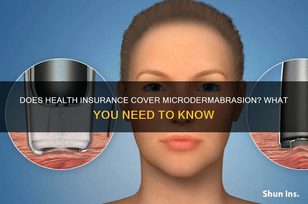 does health insurance cover microdermabrasion
