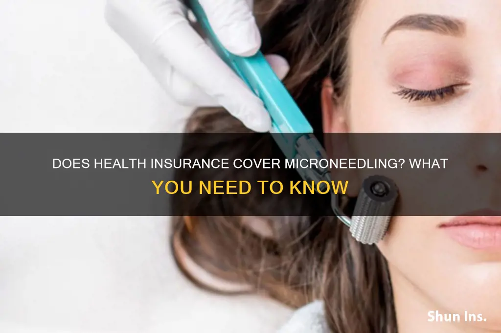does health insurance cover microneedling