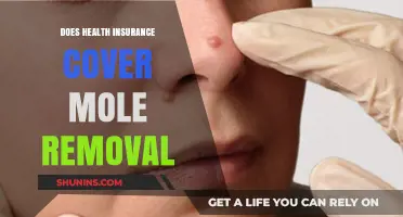 Does Health Insurance Cover Mole Removal? What You Need to Know