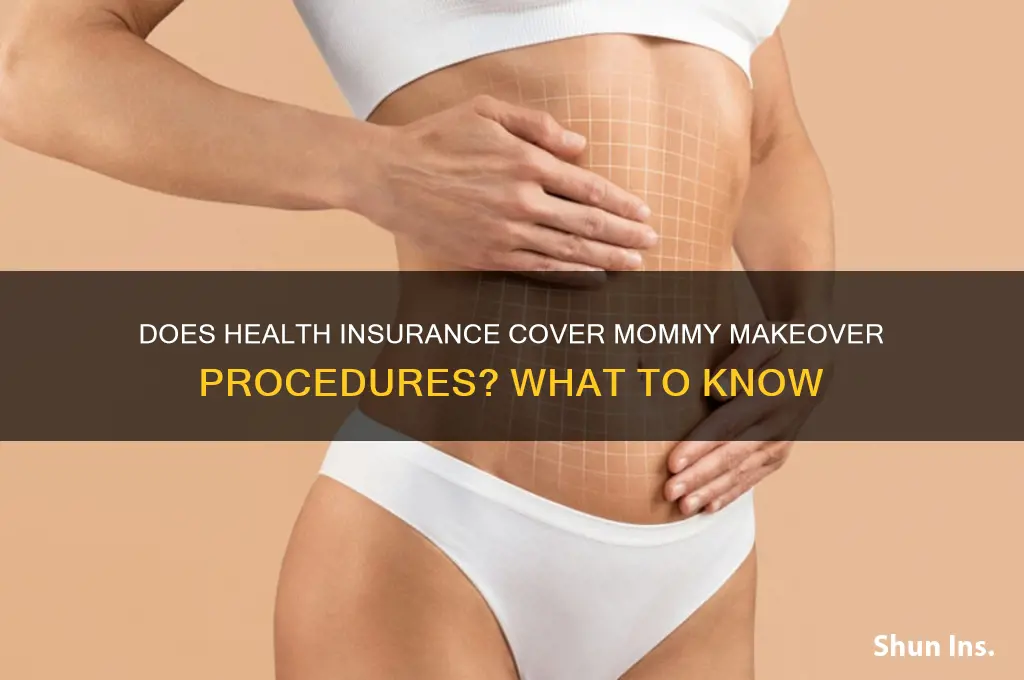 does health insurance cover mommy makeover