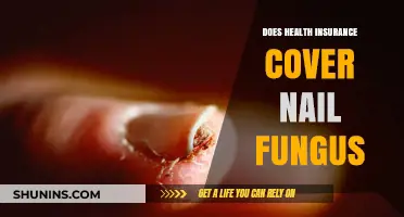 Does Health Insurance Cover Nail Fungus Treatment? What You Need to Know