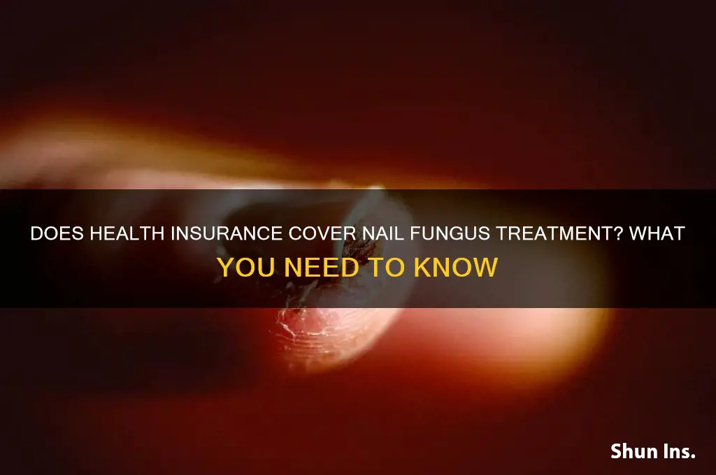 does health insurance cover nail fungus