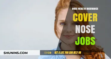 Does Health Insurance Cover Nose Jobs? What You Need to Know