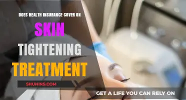 Does Health Insurance Cover Skin Tightening Treatments? What You Need to Know
