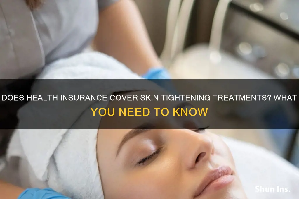 does health insurance cover on skin tightening treatment