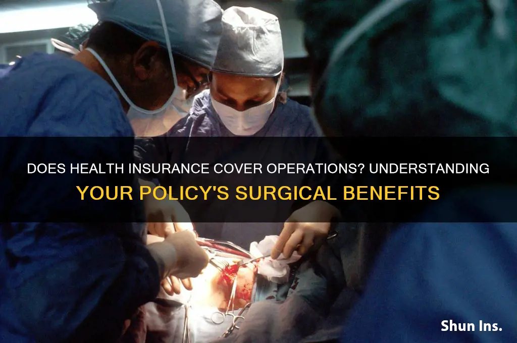 does health insurance cover operations