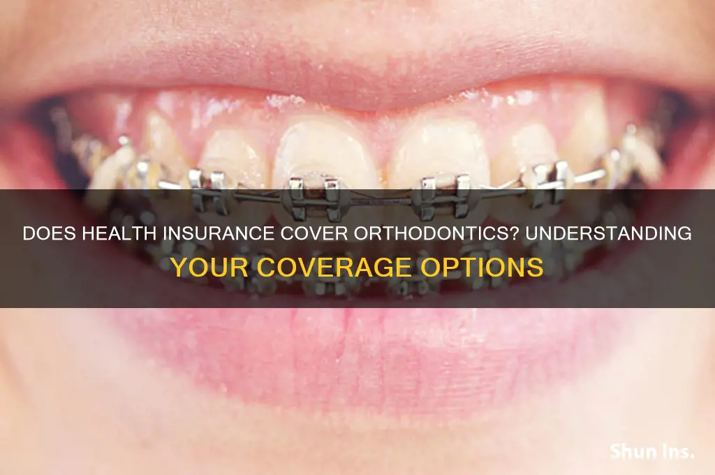does health insurance cover orthodontics