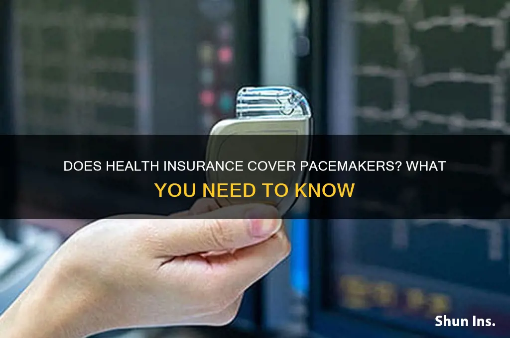 does health insurance cover pacemaker