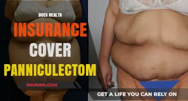 Does Health Insurance Cover Panniculectomy? Understanding Coverage and Costs
