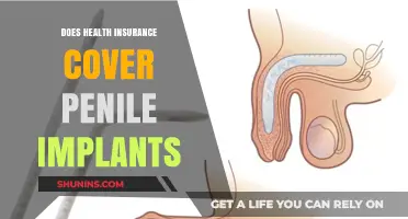 Does Health Insurance Cover Penile Implants? What You Need to Know