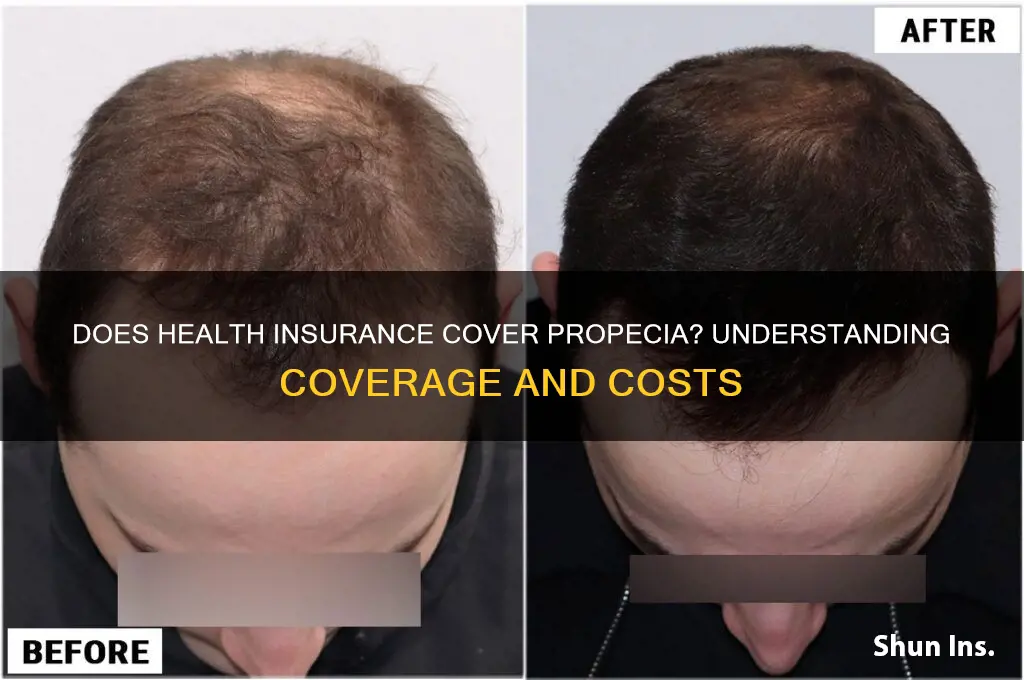 does health insurance cover propecia