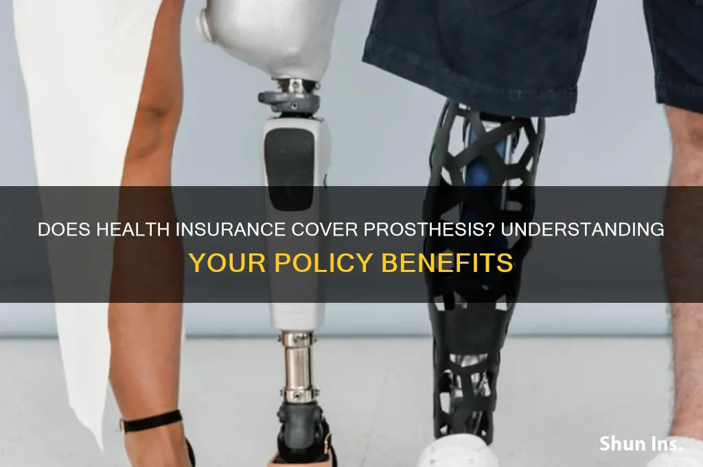 does health insurance cover prosthesis