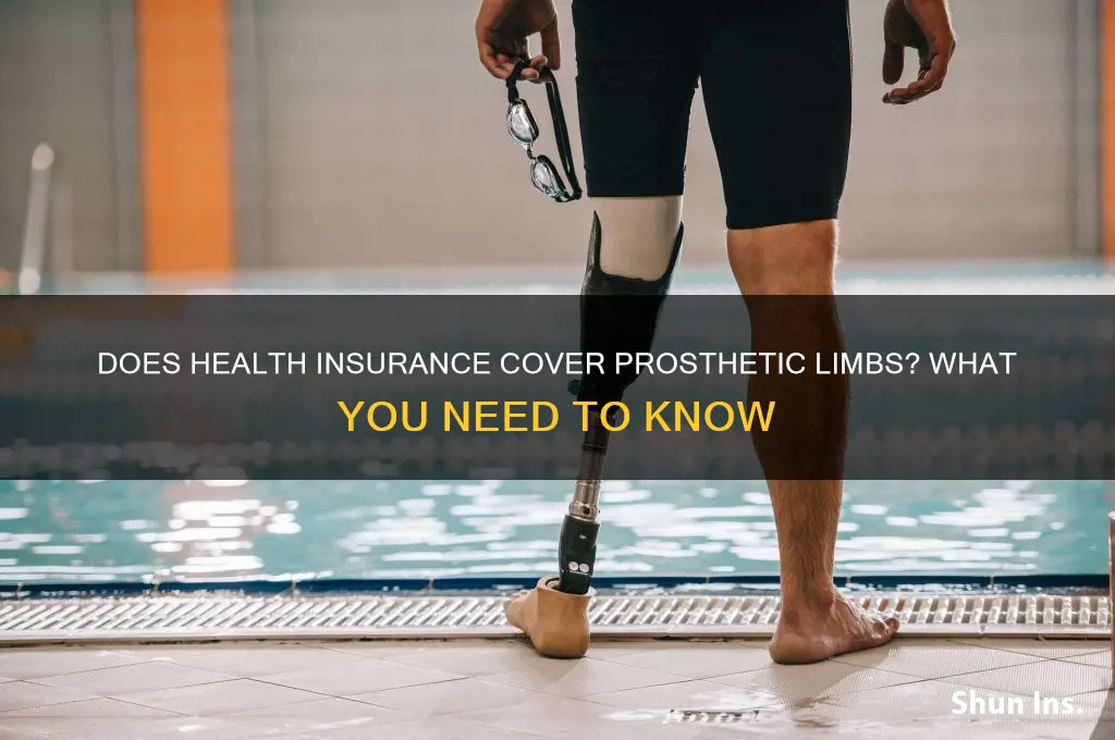 does health insurance cover prosthetic limbs