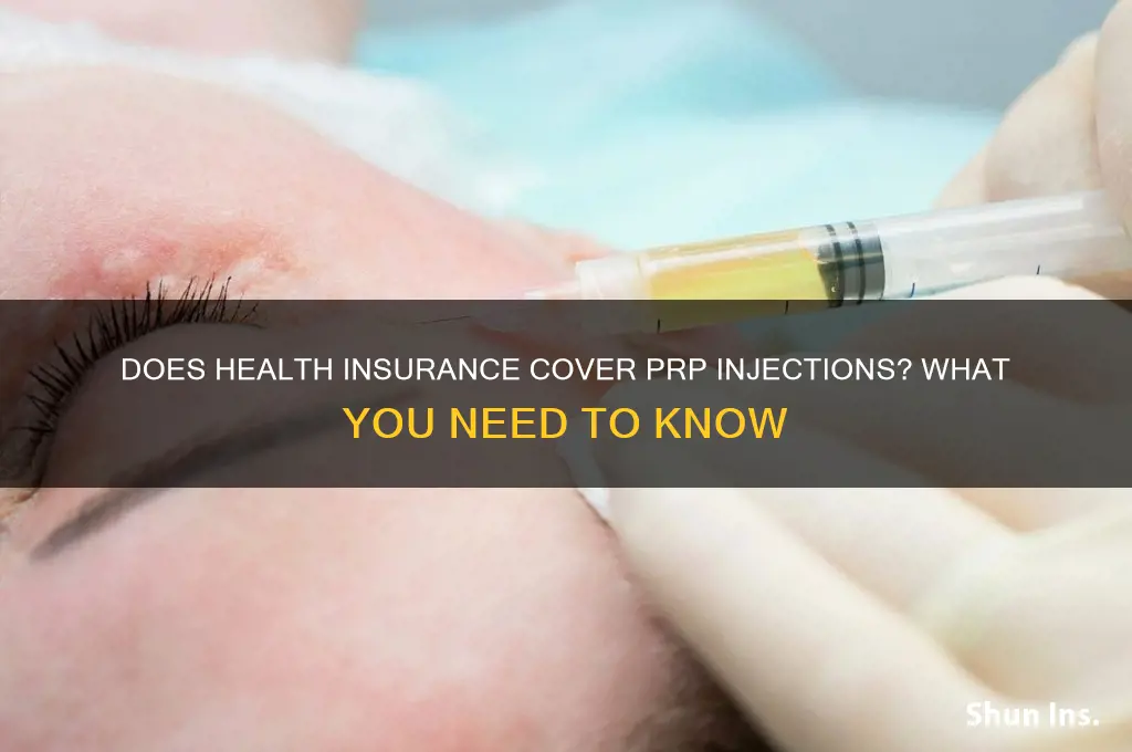 does health insurance cover prp injections