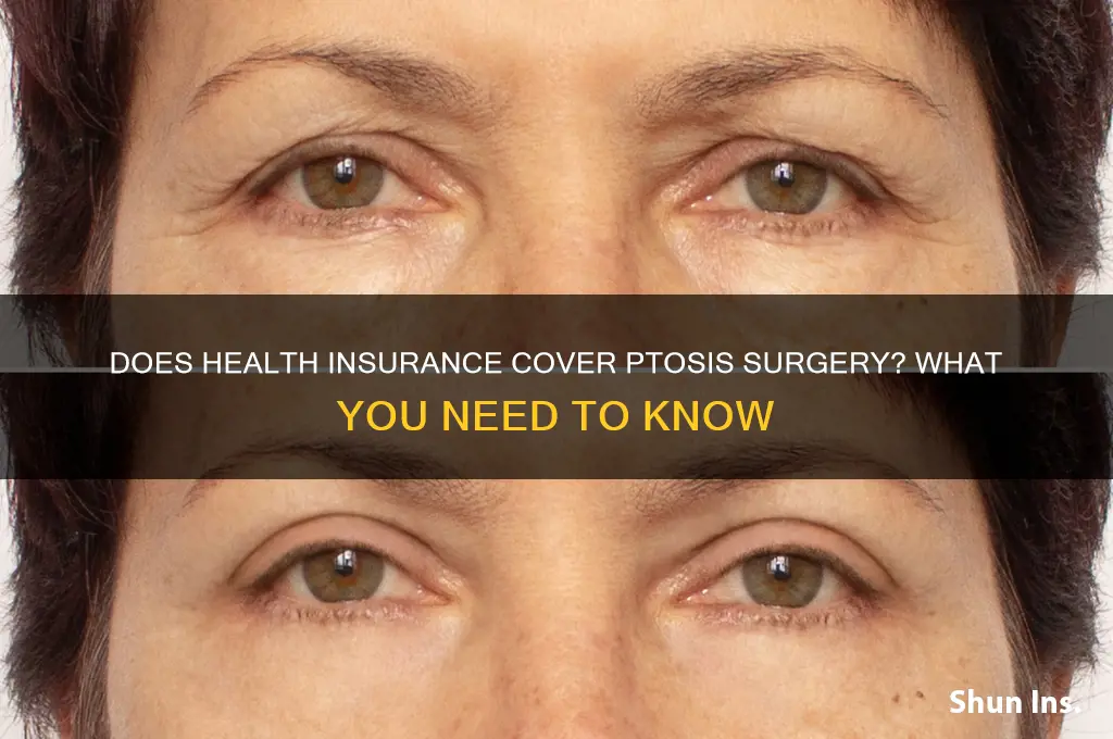 does health insurance cover ptosis surgery