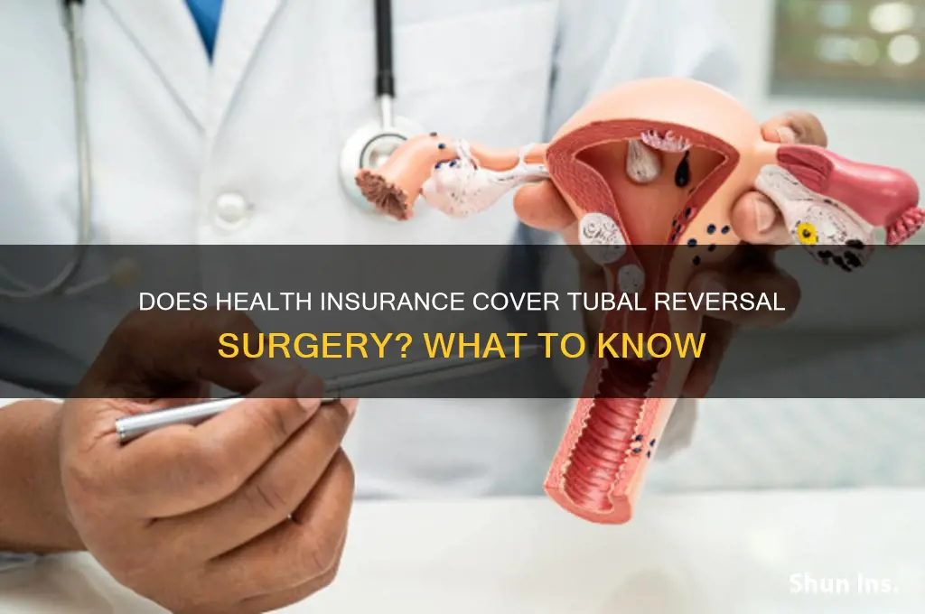 does health insurance cover reversal tubal